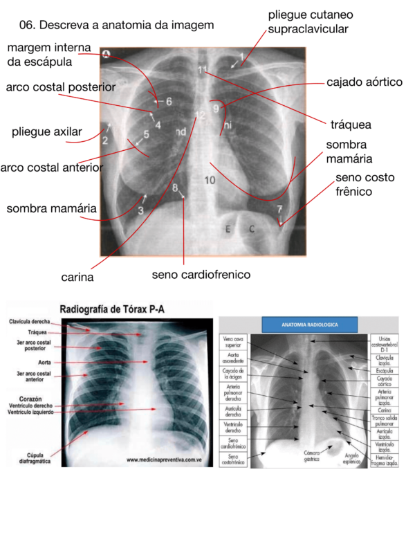 Imagenologia P1 - Image 4